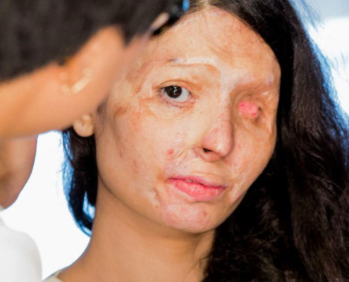 «Kulturbereicherung»: 19-jähriger Afghane attackiert Schweizer Freundin mit Säure.